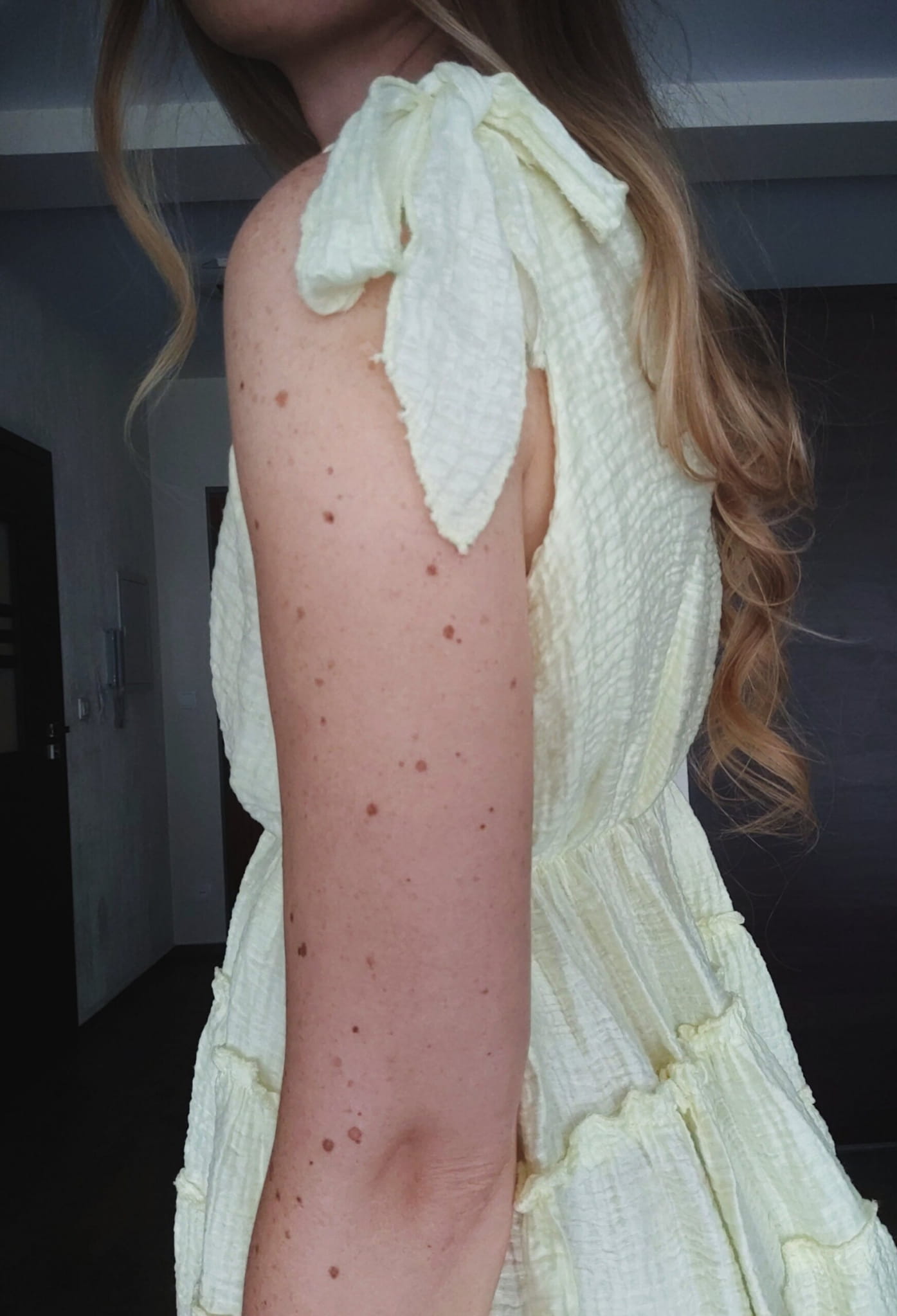 Sukienka-mini-zolty-masełkowy-kokardki (13)